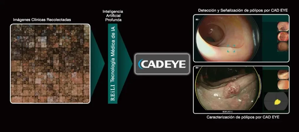 endoscopio_cadeye_fujifilm_clinica_endoscopica_avanzada