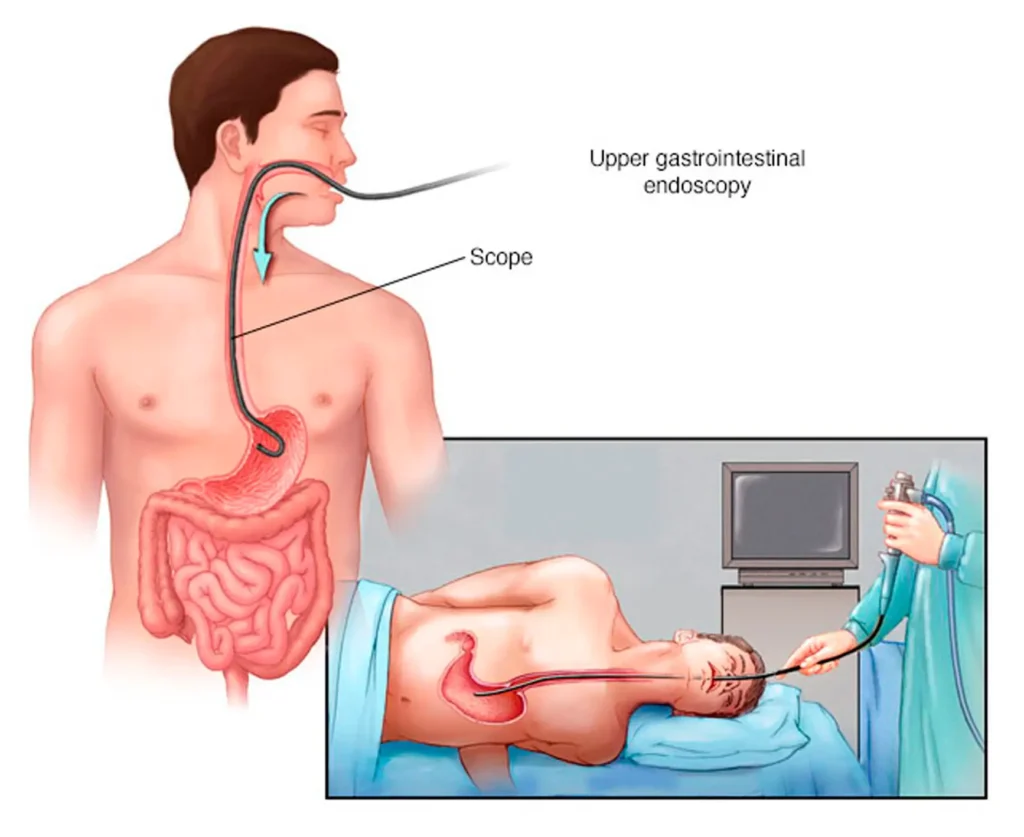 endoscopia_con_ia_clinica_de_endoscopia_avanzada