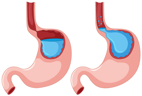 stretta_clinica_endoscopia_avanzada