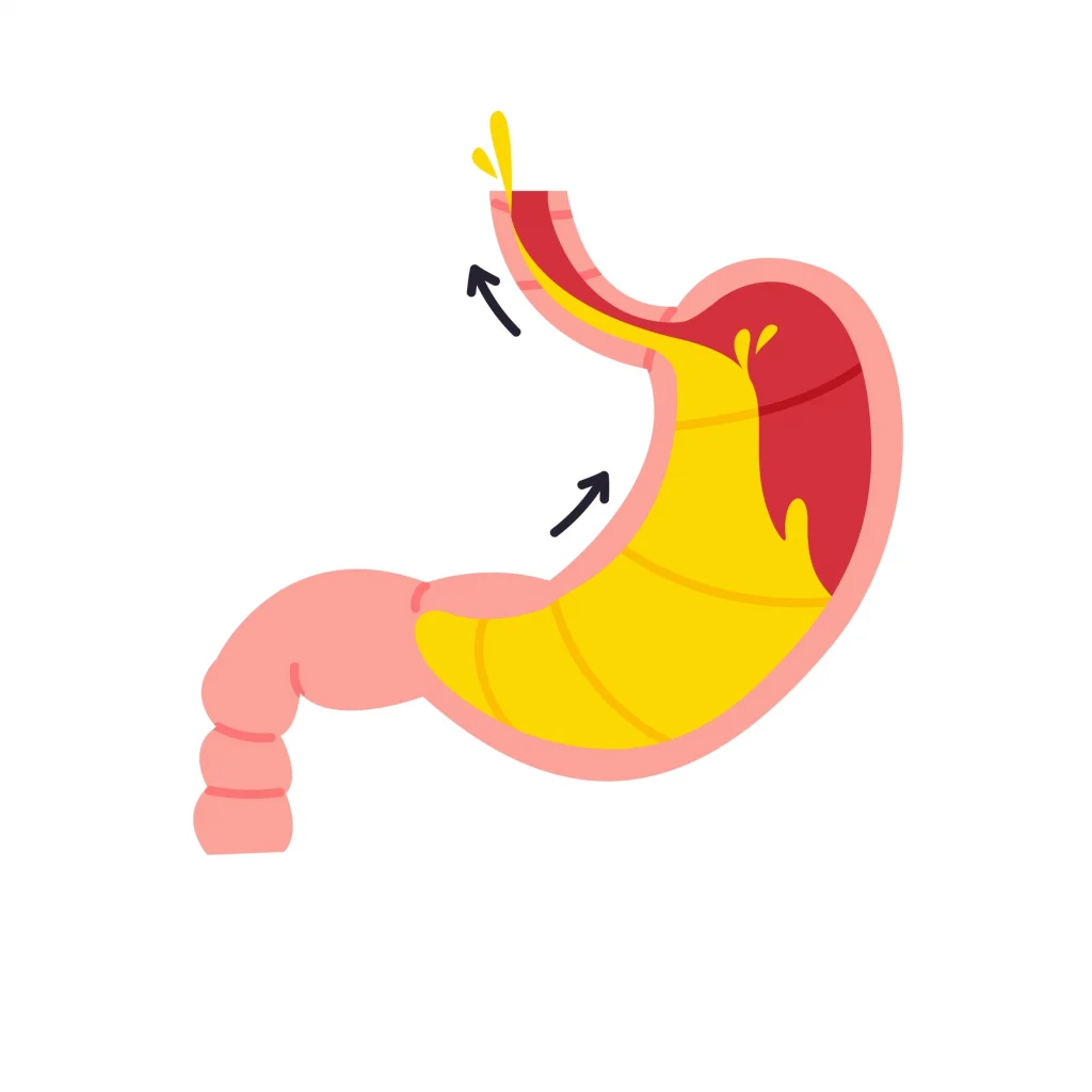 clinica-endoscopia-avanzada__examen_manometria