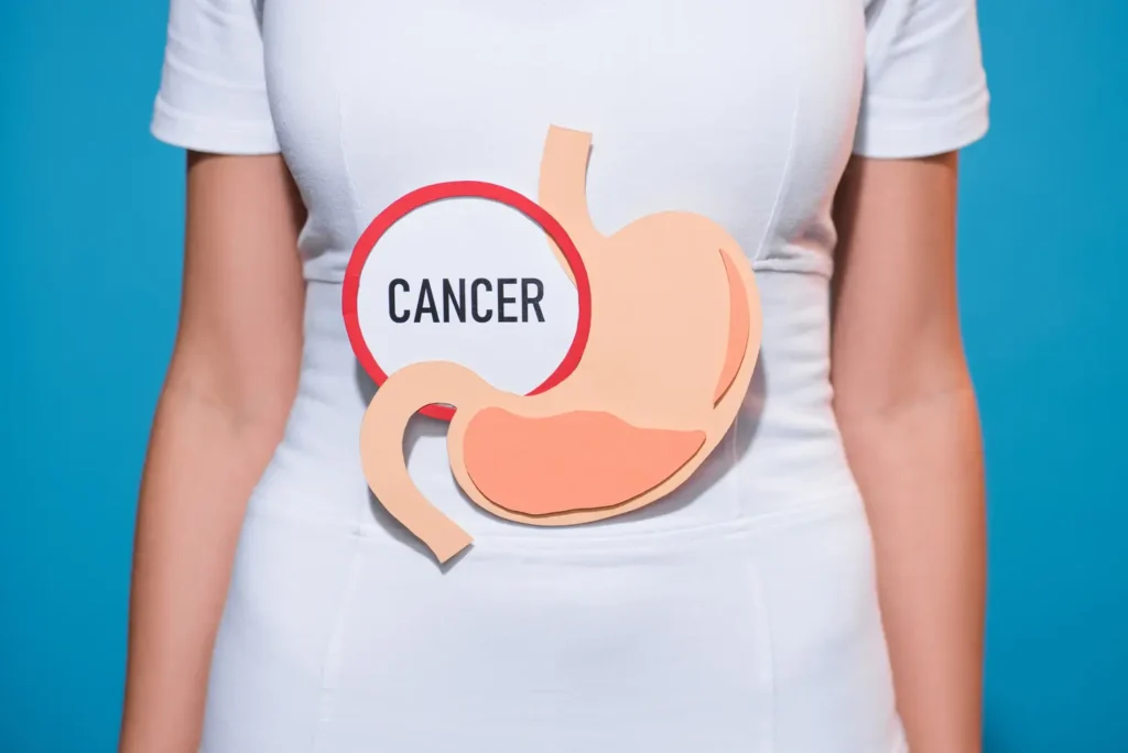 clinica_de_endocopía_avanzada | helicobacter pylori Esquema explicativo de relación entre helicobacter pylori y cáncer gástrico