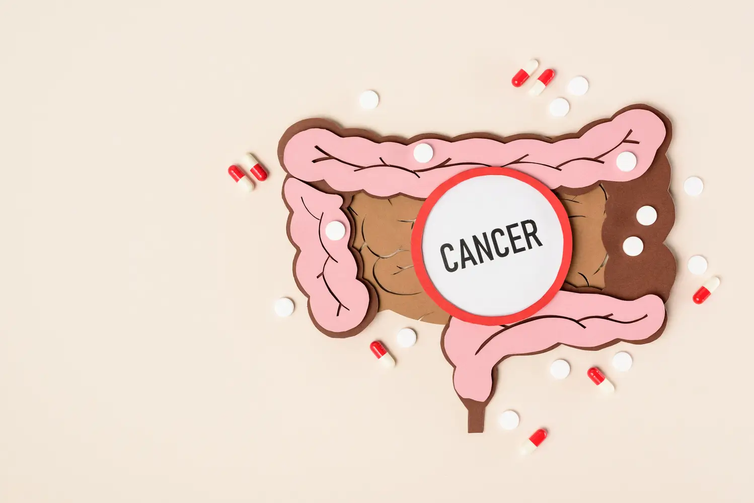 Imagen ilustrativa del sistema digestivo mostrando qué es el colon