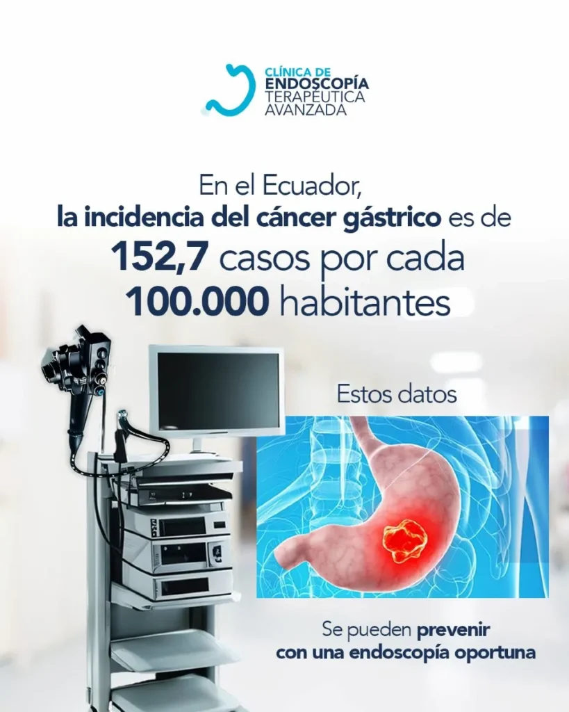 clinica_de_endocopía_avanzada | detección temprana de cáncer digestivo Deteción de cáncer clinica de endoscopia terapeutica avanzada