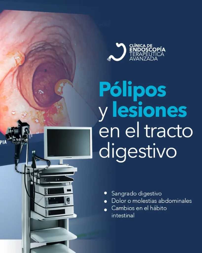 clinica_de_endocopía_avanzada | mucosectomía endoscópica