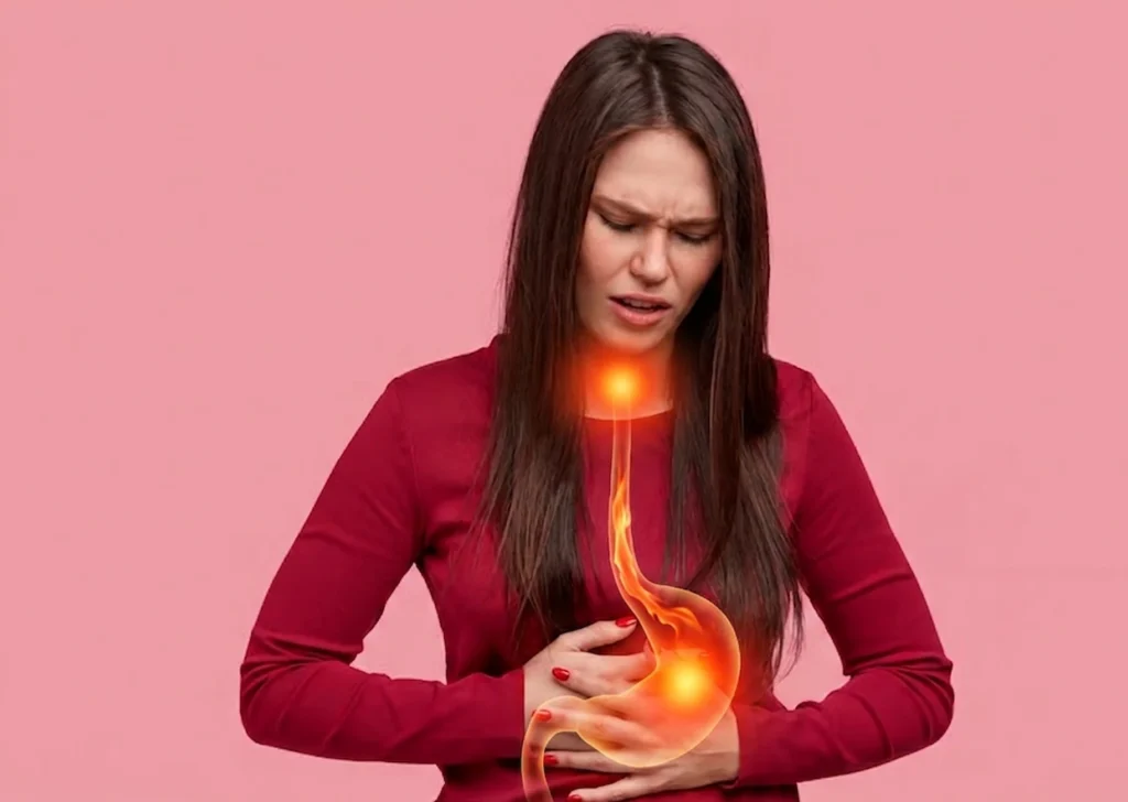 como curar el reflujo gastrico para siempre_ - clinica de endoscopia avanzada